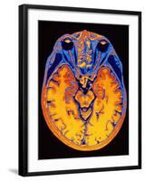 MRI Brain Scan-PASIEKA-Framed Photographic Print