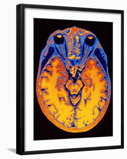 MRI Brain Scan-PASIEKA-Framed Photographic Print