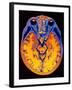 MRI Brain Scan-PASIEKA-Framed Photographic Print