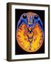 MRI Brain Scan-PASIEKA-Framed Photographic Print