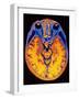 MRI Brain Scan-PASIEKA-Framed Photographic Print