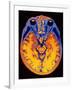 MRI Brain Scan-PASIEKA-Framed Photographic Print