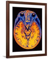 MRI Brain Scan-PASIEKA-Framed Photographic Print