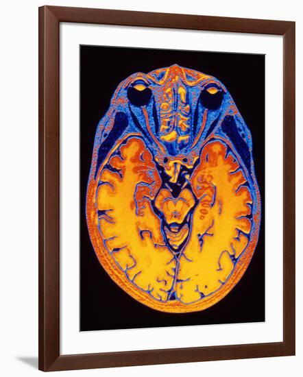 MRI Brain Scan-PASIEKA-Framed Photographic Print