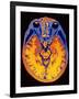 MRI Brain Scan-PASIEKA-Framed Photographic Print