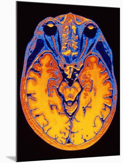 MRI Brain Scan-PASIEKA-Mounted Photographic Print