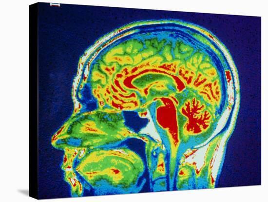 MRI Scan of Brain-null-Stretched Canvas