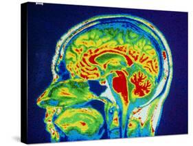 MRI Scan of Brain-null-Stretched Canvas
