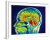 MRI Scan of Brain-null-Framed Photographic Print