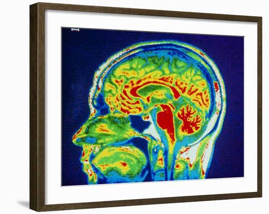 MRI Scan of Brain-null-Framed Photographic Print