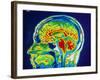 MRI Scan of Brain-null-Framed Photographic Print