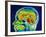 MRI Scan of Brain-null-Framed Photographic Print