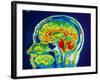 MRI Scan of Brain-null-Framed Photographic Print