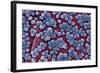 MRSA Bacteria, SEM-CDC-Framed Premium Photographic Print