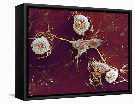 Multiple Sclerosis, SEM-Dr. John Zajicek-Framed Stretched Canvas