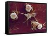 Multiple Sclerosis, SEM-Dr. John Zajicek-Framed Stretched Canvas