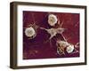 Multiple Sclerosis, SEM-Dr. John Zajicek-Framed Photographic Print