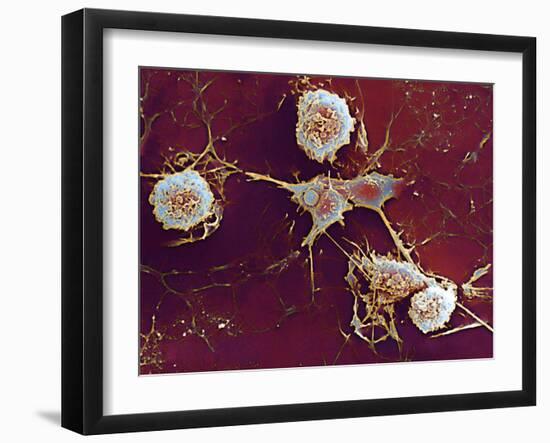 Multiple Sclerosis, SEM-Dr. John Zajicek-Framed Photographic Print