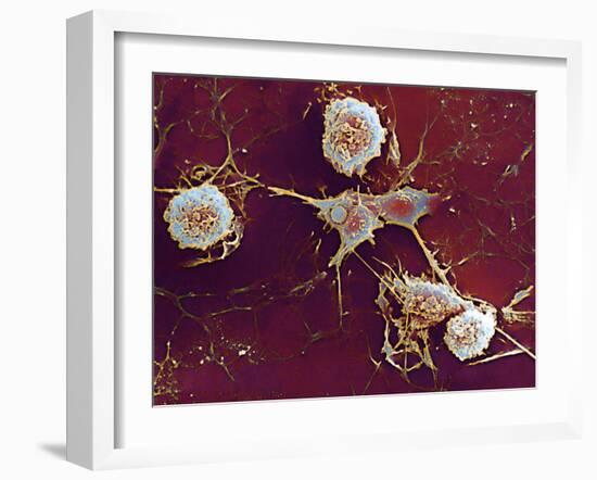 Multiple Sclerosis, SEM-Dr. John Zajicek-Framed Photographic Print