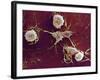 Multiple Sclerosis, SEM-Dr. John Zajicek-Framed Photographic Print