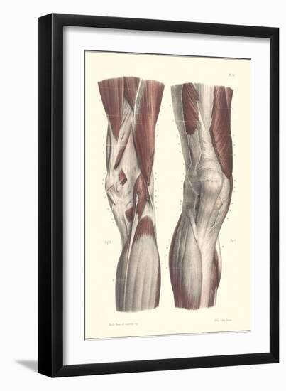 Musculature of the Knee Area-null-Framed Art Print