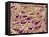 Mycelium of Mushroom-Micro Discovery-Framed Stretched Canvas