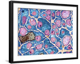 Myelination of Nerve Fibres, TEM-Thomas Deerinck-Framed Photographic Print