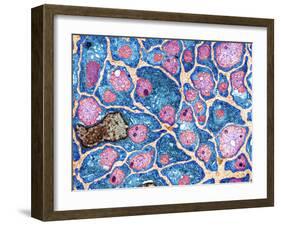 Myelination of Nerve Fibres, TEM-Thomas Deerinck-Framed Photographic Print