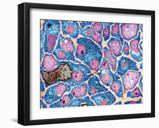 Myelination of Nerve Fibres, TEM-Thomas Deerinck-Framed Photographic Print