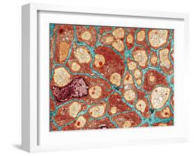 Myelination of Nerve Fibres, TEM-Thomas Deerinck-Framed Photographic Print