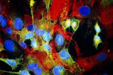 Immunofluorescent LM of HeLa Cells In Culture-Nancy Kedersha-Photographic Print