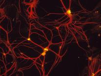 Immunofluorescent LM of Neurons & Astrocytes-Nancy Kedersha-Photographic Print