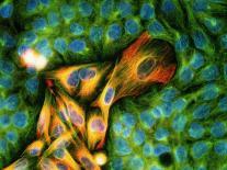 Immunofluorescent LM of Melanoma Cancer Cells-Nancy Kedersha-Photographic Print