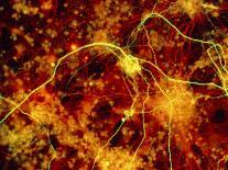 Immunofluorescent LM of Neurons & Astrocytes-Nancy Kedersha-Photographic Print
