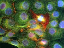 Immunofluorescent LM of Prostate Cancer Cells-Nancy Kedersha-Photographic Print