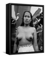 Native Woman with Love Scars on Arm-Eliot Elisofon-Framed Stretched Canvas