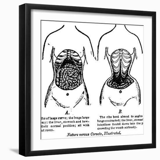 Nature Versus Corsets, 1903-null-Framed Giclee Print