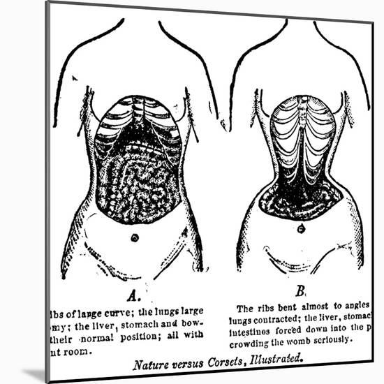 Nature Versus Corsets, 1903-null-Mounted Giclee Print