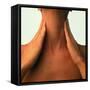 Neck Massage: Hands of Woman During Self-massage-Phil Jude-Framed Stretched Canvas