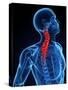 Neck Pain, Conceptual Artwork-SCIEPRO-Stretched Canvas