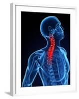 Neck Pain, Conceptual Artwork-SCIEPRO-Framed Photographic Print