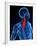 Neck Pain, Conceptual Artwork-SCIEPRO-Framed Photographic Print