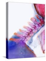 Neck Vertebrae Extended, X-ray-Science Photo Library-Stretched Canvas