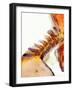 Neck Vertebrae Extended, X-ray-Science Photo Library-Framed Photographic Print