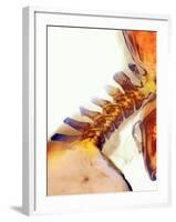 Neck Vertebrae Extended, X-ray-Science Photo Library-Framed Photographic Print