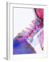 Neck Vertebrae Extended, X-ray-Science Photo Library-Framed Photographic Print