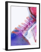 Neck Vertebrae Extended, X-ray-Science Photo Library-Framed Photographic Print