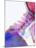 Neck Vertebrae Extended, X-ray-Science Photo Library-Mounted Photographic Print