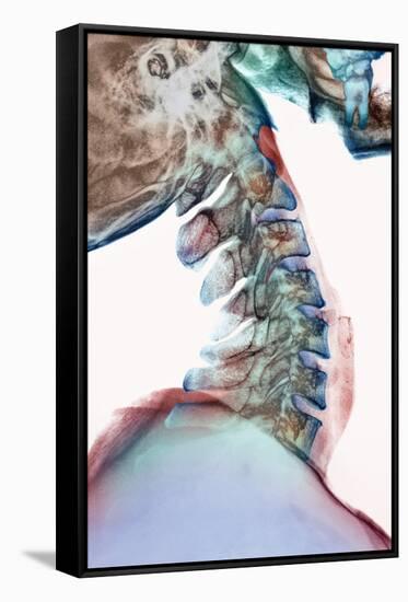 Neck Vertebrae Flexed, X-ray-Science Photo Library-Framed Stretched Canvas