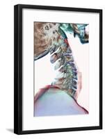 Neck Vertebrae Flexed, X-ray-Science Photo Library-Framed Photographic Print